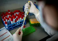 Fransadan koronavirüs hakkında umutlandıran çalışma! Hastaların yüzde yüzü...