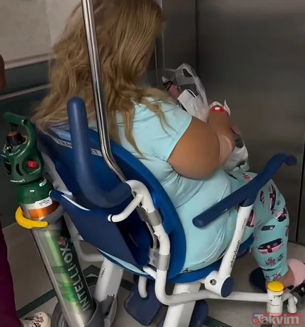 Midesi Kalbinin Arkasına Sıkıştı: Zayıflama Ameliyatı Hayatını Cehenneme Çevirdi - 3