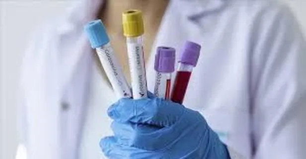 Yeni vaka 933’e indi