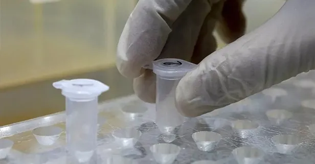 Filyasyon ne demek? Filyasyon ekibi ne iş yapar? Filyasyon nasıl yapılıyor?