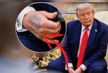 ABD’de Trump spekülasyonları: Morluk ve şişlik iddiaları gündemde