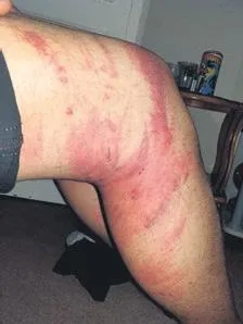 Afyon’da baba ve kızı birer gün arayla kanserden hayatını kaybetti-8