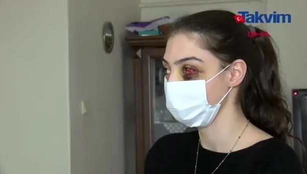 İstanbul’da telefonda video izlediği için kocasından feci şekilde dayak yiyen kadın: Ölmeyi mi bekliyeyim?
