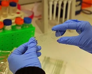 İstanbul’da, sivrisinekle gelen Batı Nil Ateşli Virüsü tehlikesi