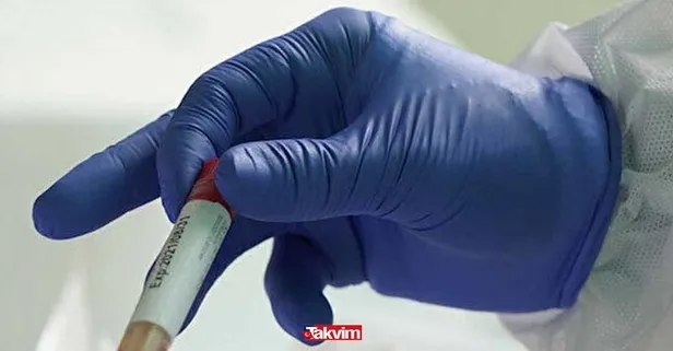 gozler oradaydi pcr testi sonucu nasil ogrenilir test sonucu ne zaman cikar pcr testi nerede yapilir pcr testini kimler yaptiracak takvim gozler oradaydi pcr testi sonucu nasil ogrenilir test sonucu ne zaman cikar pcr testi nerede yapilir pcr testini kimler yaptiracak takvim