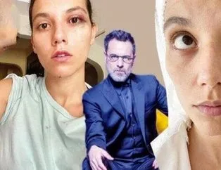 Ben ’Deniz’ acı