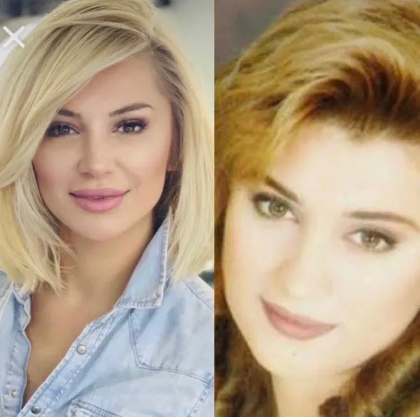 Songül Karlı estetikle komple yüzünü değiştirmiş görenler tanıyamadı! 'Estetiğim yok' diye ortalarda dolaşan Songül Karlı...-6