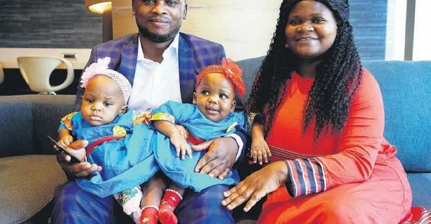 Kalçaları bitişik olarak dünyaya gelen Kamerunlu ikizler, Türkiye’de 27 saat sonra ameliyatla ayrıldı