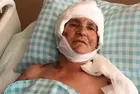 Yargıtay'dan emsal karar: Köpek saldırısında yaralanan kadına 637 bin lira tazminat kararı