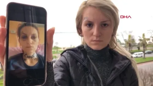 Zonguldak Ereğli’de Ufuk Özel’in 9 bıçak darbesiyle ağır yaraladığı Çağla Çiçekçi: İzleri her gördüğümde olay canlanıyor! Adalet yerini bulsun