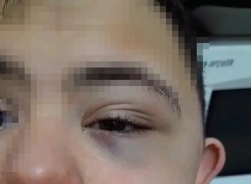 Down sendromlu Berat öğretmeni tarafından dövüldü tekmelendi: Üstüne basıp yerlerde sürükledi ailesine ise...-2