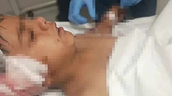 Ankara Altındağ’da başıboş köpek saldırısı: 1. sınıf öğrencisi Davut Elhamut'u vatandaşlar son anda kurtardı!