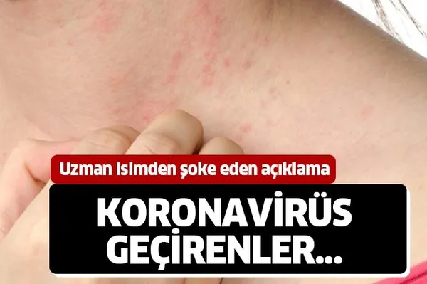 uzman isim ilk kez acikladi deri