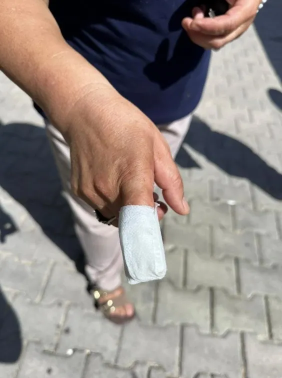 1788018662397.jpeg Karşıyaka'da talihsiz kadın pitbull saldırısına uğradı: Parmağı koptu-4