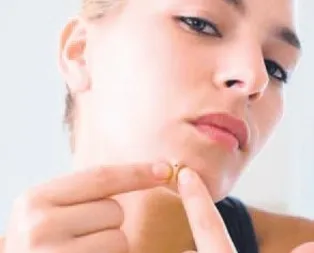 Sivilceye limon yağı