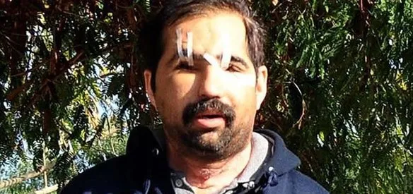 Türkiye'nin altıncı yüz nakli yapıldı. Antalya'da beyin ölümü gerçekleşen Muhittin Turan'ın yüzü 8 saat süren operasyonla alınarak Prof. Dr. Ömer Özkan başkanlığındaki ekip tarafından 54 yaşındaki Salih Üslün'e nakledildi