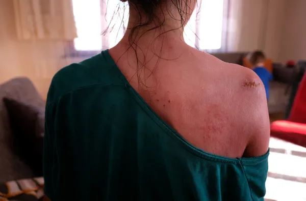 esinin-sicak-su-dokerek-hasladigi-rukiye-ayin-yurek-yakan-sozleri-bana-abla-diyor-1611992011310.jpg Eşinin sıcak su dökerek haşladığı Rukiye Ay'ın yürek yakan sözleri: Bana abla diyor-2