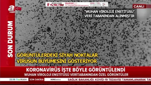 Wuhan Viroloji Enstitüsü dünyaya duyurdu: İşte Kovid-19 virüsünün en net görüntüsü!