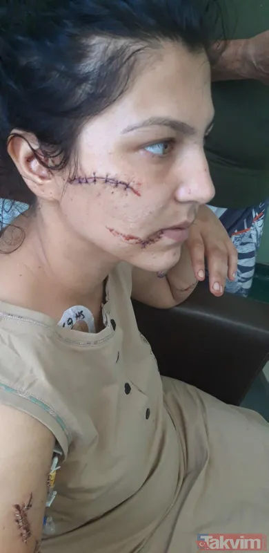 İzmir'de dini nikahlı eşinin 104 yerinden bıçakladığı Aysel Perkgün: Can çekişirken sigara içti oğlumu üzerime koydu - 5