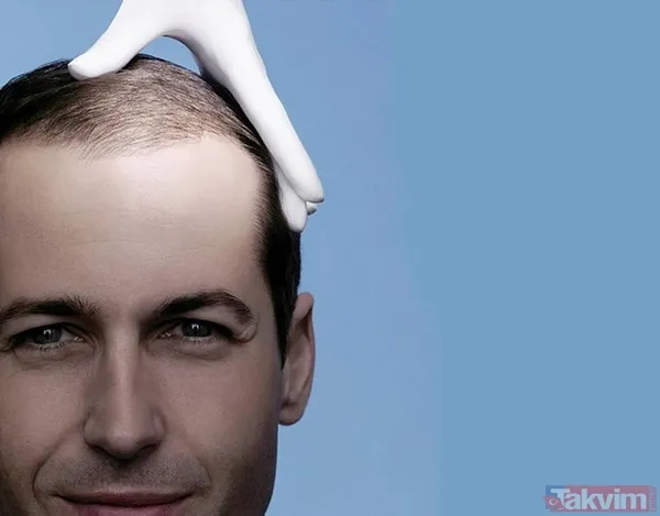 Kelliğin merhemi bulundu hem de mutfağınızda! Çare yine evden çıktı ama 40 yıl düşünsek aklımıza gelmez meğer... - 9