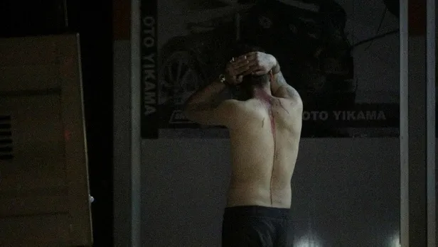 SON DAKİKA: Bursa'da kan donduran olay: Başına çivili sopa ile vurdular ambulansta linç etmeye çalıştılar-3