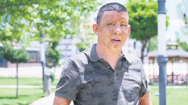 Gökhan Baran'ın hayatını Başkan Erdoğan değiştirdi: "O benim kahramanım"-2