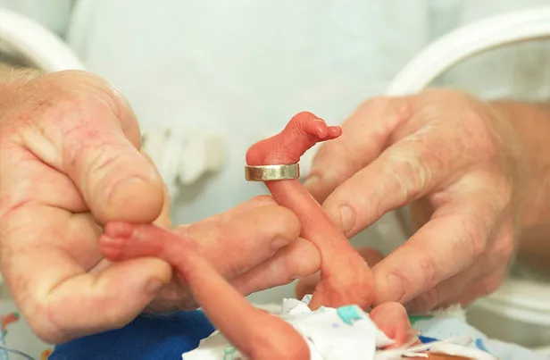 ruyada-olu-bebek-gormek-ne-anlama-gelir-ruyada-olmus-bebek-gormek-neye-isarettir-ruyada-olu-bebegin-canlandigi-1657048248587.jpg Rüyada ölü bebek görmek ne anlama gelir? Rüyada ölmüş bebek görmek neye işarettir? Rüyada ölü bebeğin canlandığını görmek...-3