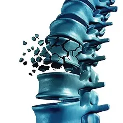 Kemikler için harekete geç