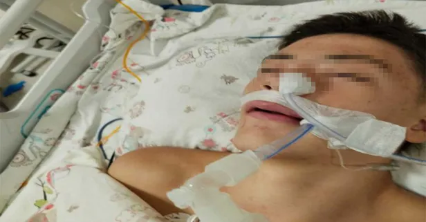 Okulda akran dehşeti! 'Ayağına bastı' diye arkadaşı tarafından feci şekilde dövüldü