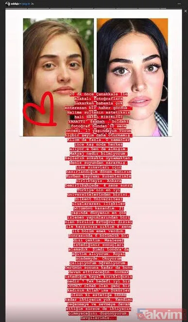 Ramo'nun Sibel'i Esra Bilgiç'in bu halini gören Esra olduğuna inanmıyor! Estetik var mı yok mu Esra Bilgiç açıkladı - 26