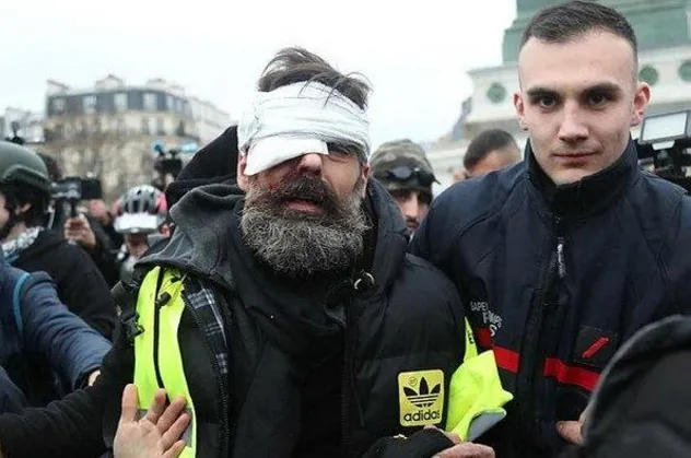 Fransa'da polis Flash-Ball mermisi kullandı 100 kişi gözünü kaybetti!