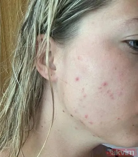 5 Adımda Sıfır Şişkinlik Kabukları Soyma: Patates, Elma Ve Hatta Kiviyi İyice Yıkayıp Kabuğuyla Tüketin. Lif Kazancınız %50 Artar. Gökkuşağı Kuralı: Tabağınızda...