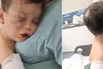 Denizli'de korkunç olay! Sevgilisinin 2 yaşındaki oğlunu darbeden şüpheli tutuklandı