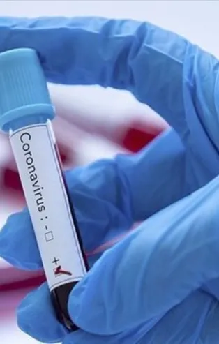 Covid-19 test sonucu nasıl öğrenilir? E devlet ile Covid 19 test sonucu öğrenme ekranı!