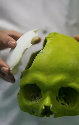 Kanser cerrahisinde '3D' teknolojisi