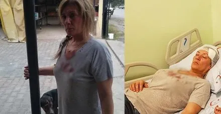 Yavru köpekleri beslerken dehşeti yaşadı