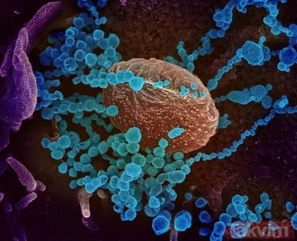 Bilim insanları ilk kez paylaştı! İşte dünyaya korku salan corona virüsün görüntüsü