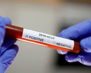 Son dakika: Japonyada ilk Koronavirüs ölümü!