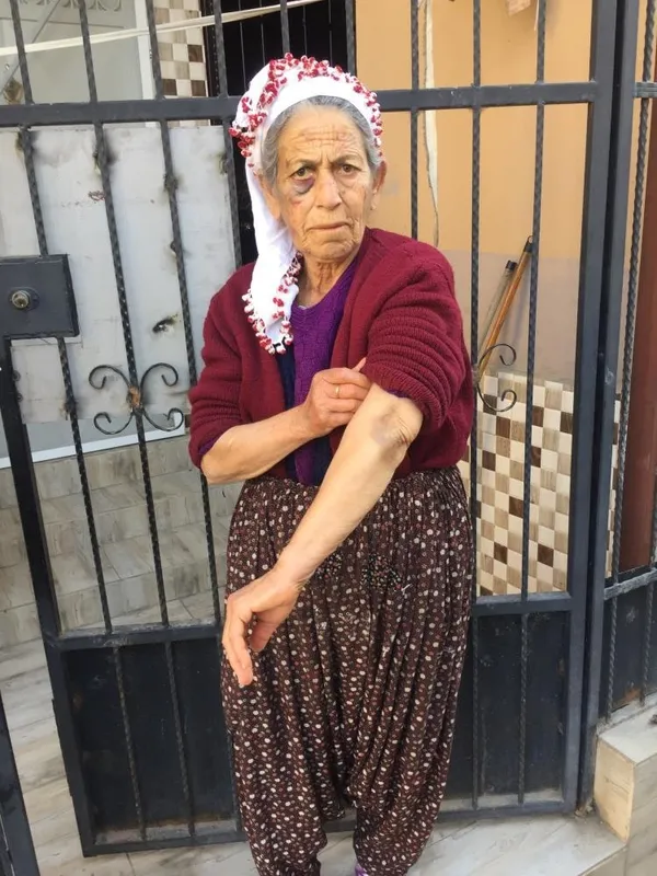 72-yasindaki-kanser-hastasi-kadini-bayiltana-kadar-dovup-para-ve-altinlarini-aldi-1672645766656.jpeg 72 yaşındaki kanser hastası kadını bayıltana kadar dövüp, para ve altınlarını aldı!-2
