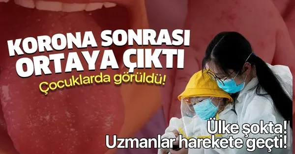 Son Dakika Ingiltere Sokta Koronavirus Sonrasi Cocuklarda Ortaya Cikti Uzmanlar Harekete Gecti Takvim