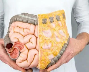 Kolonu erkenden yakalayın