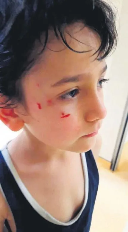 400 bin TL'ye satın aldığı otomobili komşu çizdi! (Yaşam haberleri)-4