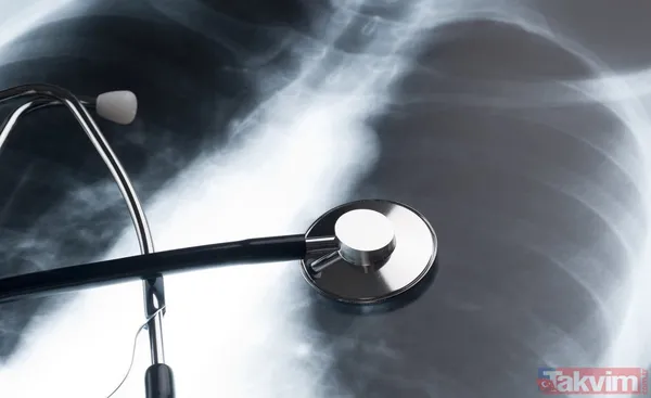 Vücuttaki zehri atmak için yalnızca tek kaşık yemek yeterli bir eşi daha yok! Sigara içenler bu mucize besini mutlaka tüketmeli - 16