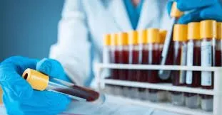 Başakşehir Çam ve Sakura Şehir Hastanesi tahlil sonuçları! MHRS tahlil sonucu sorgulama ekranı!-4