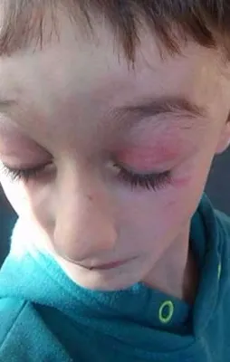 Çocuklara Nazi zulmü