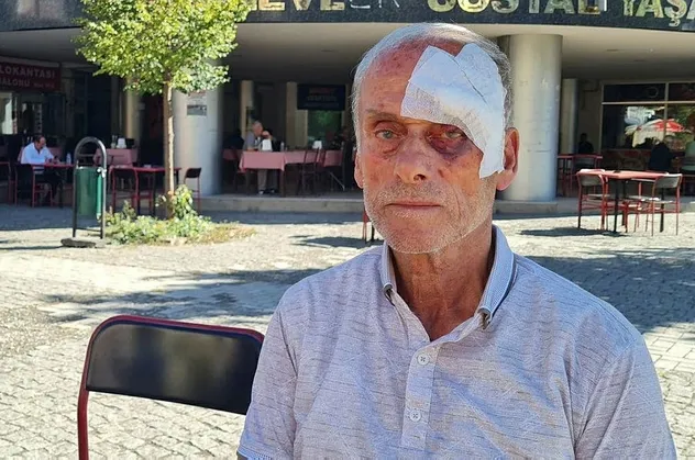 CHP Karabük İl Başkanlığında darp skandalı! 72 yaşındaki parti üyesi il sekreteri tarafından hastanelik edildi