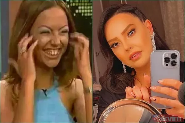 Gamze Özçelik’in eski eşi Uğur Pektaş yeni haliyle tanınmaz halde! 'Yolda görsem...' Arka Sokaklar'ın başrolüydü! - 11