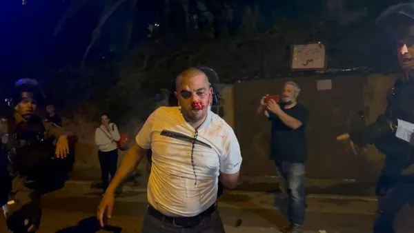 israil-gucleri-gazze-sinirindaki-filistinlilere-orantisiz-kuvvetle-saldiriyor-1620600344091.jpg İsrail güçleri, Gazze sınırındaki Filistinlilere orantısız kuvvetle saldırıyor-1