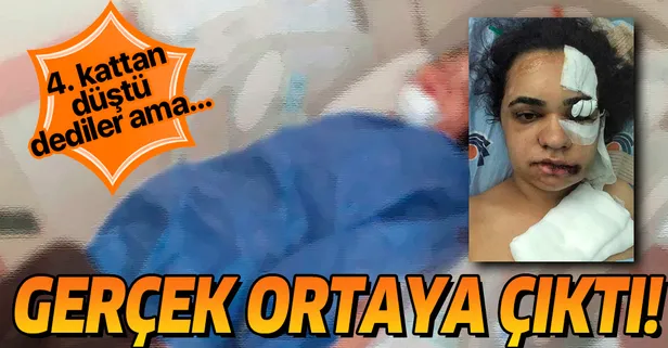 Malatya'da 4. kattan düştüğü iddia edilen kadın her şeyi anlattı!