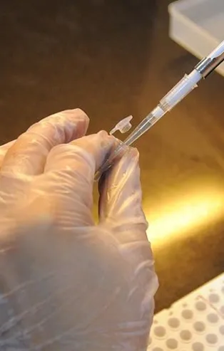 Kök hücre nakliyle kanseri yendi